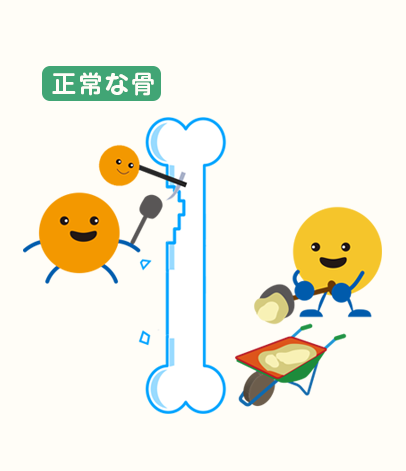 骨粗しょう症のイメージ1