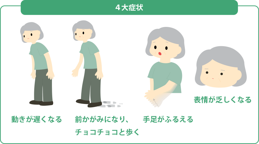 パーキンソン病のイメージ